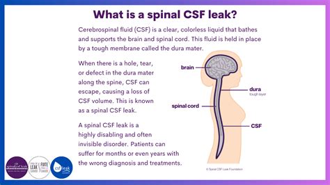 Cerebrospinal Fluid Leak Repair 